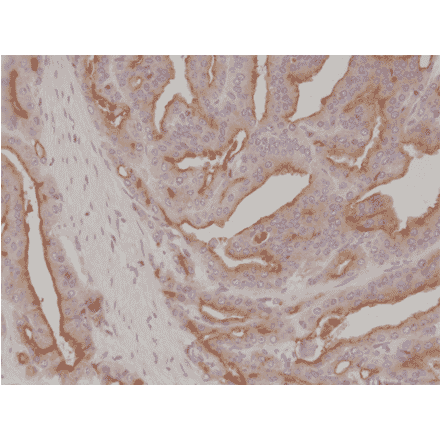 Immunohistochemistry - Anti-PSMA Antibody [RM327] (A121495) - Antibodies.com
