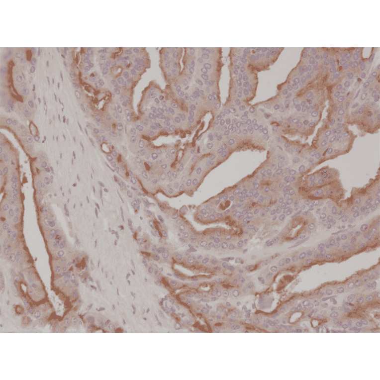 Immunohistochemistry - Anti-PSMA Antibody [RM327] (A121495) - Antibodies.com