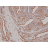 Immunohistochemistry - Anti-PSMA Antibody [RM327] (A121495) - Antibodies.com