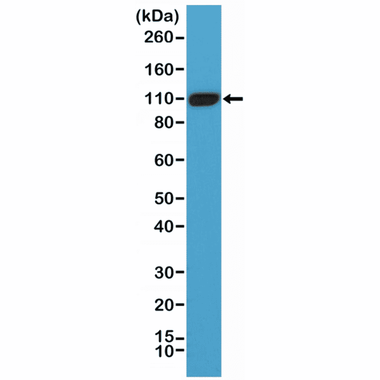 Western Blot - Anti-PSMA Antibody [RM327] (A121436) - Antibodies.com