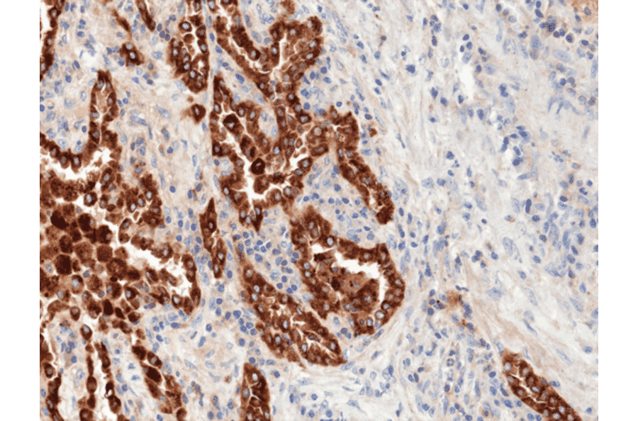 Immunohistochemistry - Anti-Prosurfactant Protein B Antibody [RM370] (A121419) - Antibodies.com