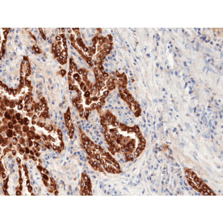 Immunohistochemistry - Anti-Prosurfactant Protein B Antibody [RM370] (A121419) - Antibodies.com