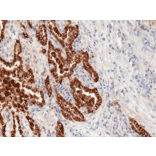 Immunohistochemistry - Anti-Prosurfactant Protein B Antibody [RM370] (A121419) - Antibodies.com