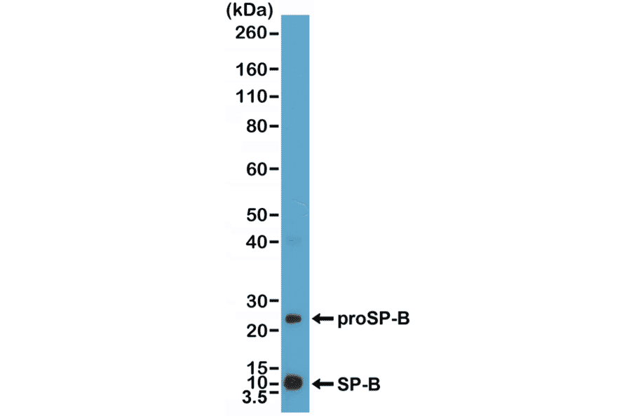 Western Blot - Anti-Prosurfactant Protein B Antibody [RM370] (A121437) - Antibodies.com