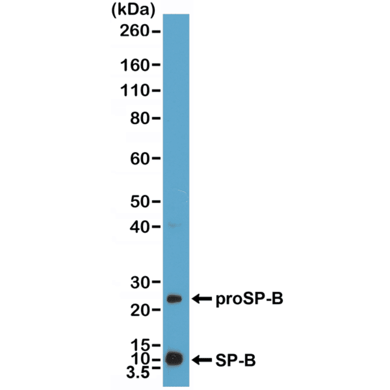 Western Blot - Anti-Prosurfactant Protein B Antibody [RM370] (A121437) - Antibodies.com