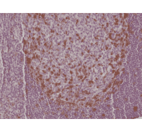 Immunohistochemistry - Anti-PD1 Antibody [RM309] (A121373) - Antibodies.com