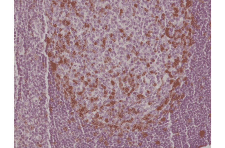 Immunohistochemistry - Anti-PD1 Antibody [RM309] (A121373) - Antibodies.com