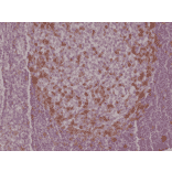 Immunohistochemistry - Anti-PD1 Antibody [RM309] (A121373) - Antibodies.com