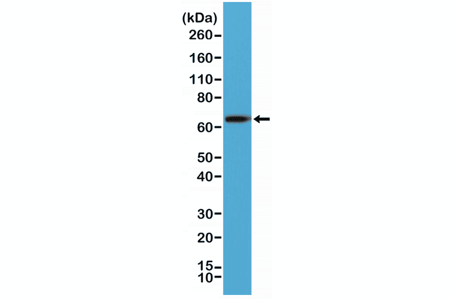 Western Blot - Anti-Placental Alkaline Phosphatase Antibody [RM317] (A121439) - Antibodies.com