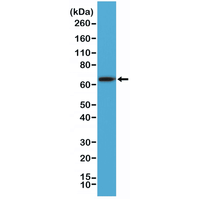 Western Blot - Anti-Placental Alkaline Phosphatase Antibody [RM317] (A121439) - Antibodies.com