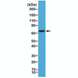 Western Blot - Anti-Placental Alkaline Phosphatase Antibody [RM317] (A121439) - Antibodies.com