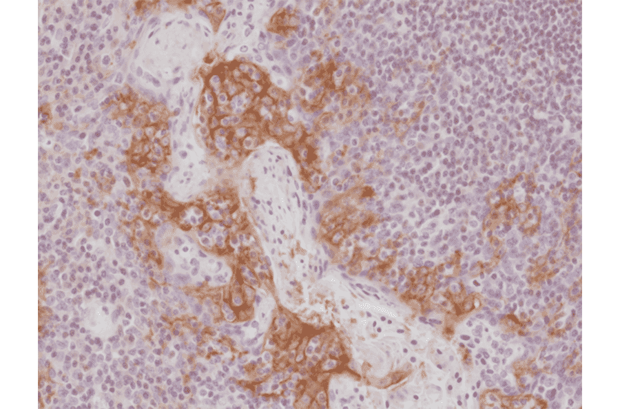 Immunohistochemistry - Anti-PD-L1 Antibody [RM320] (A121440) - Antibodies.com