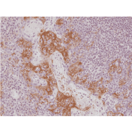 Immunohistochemistry - Anti-PD-L1 Antibody [RM320] (A121440) - Antibodies.com