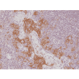 Immunohistochemistry - Anti-PD-L1 Antibody [RM320] (A121440) - Antibodies.com