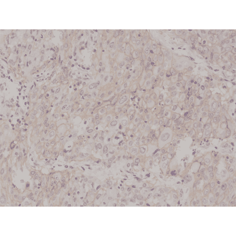 Immunohistochemistry - Anti-PD-L1 Antibody [RM320] (A121247) - Antibodies.com