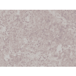 Immunohistochemistry - Anti-PD-L1 Antibody [RM320] (A121247) - Antibodies.com