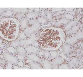 Immunohistochemistry - Anti-PDGF Receptor beta Antibody [RM303] (A121371) - Antibodies.com