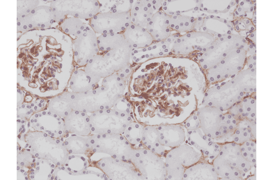 Immunohistochemistry - Anti-PDGF Receptor beta Antibody [RM303] (A121371) - Antibodies.com