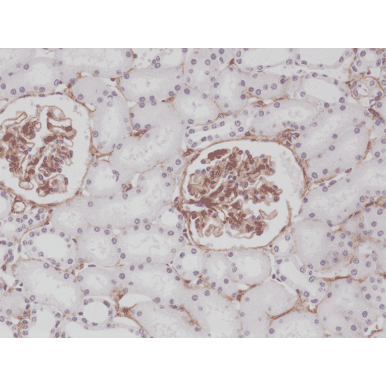 Immunohistochemistry - Anti-PDGF Receptor beta Antibody [RM303] (A121371) - Antibodies.com