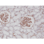 Immunohistochemistry - Anti-PDGF Receptor beta Antibody [RM303] (A121371) - Antibodies.com
