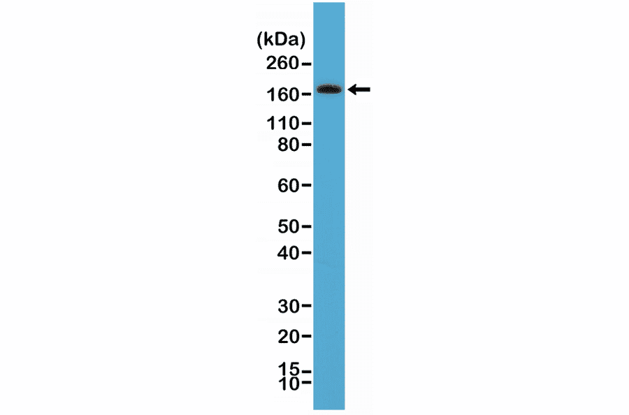 Western Blot - Anti-PDGF Receptor beta Antibody [RM303] (A121441) - Antibodies.com