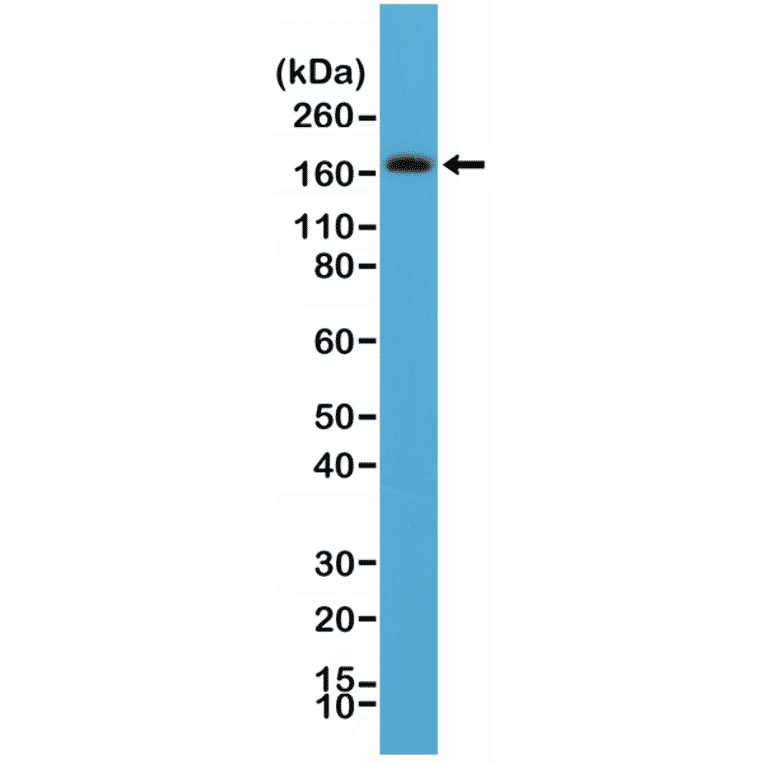 Western Blot - Anti-PDGF Receptor beta Antibody [RM303] (A121441) - Antibodies.com