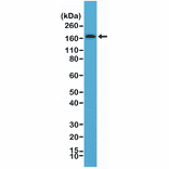 Western Blot - Anti-PDGF Receptor beta Antibody [RM303] (A121441) - Antibodies.com
