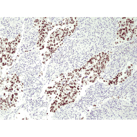 Immunohistochemistry - Anti-p53 Antibody [RM387] (A121364) - Antibodies.com