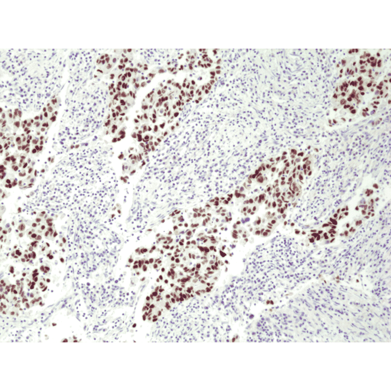 Immunohistochemistry - Anti-p53 Antibody [RM387] (A121364) - Antibodies.com