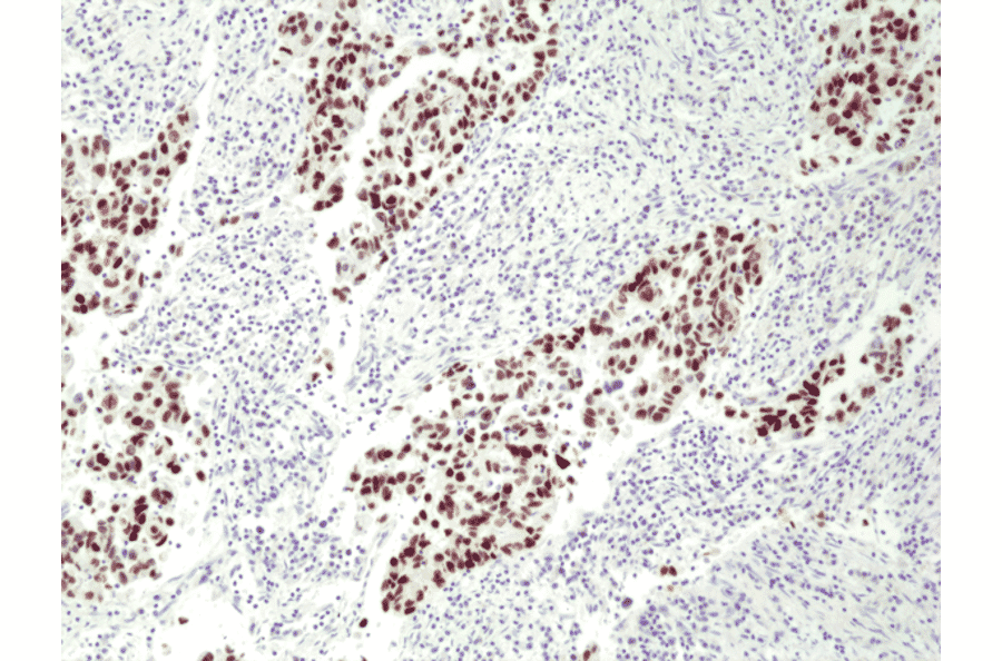 Immunohistochemistry - Anti-p53 Antibody [RM387] (A121443) - Antibodies.com