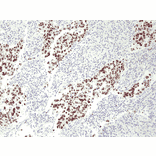 Immunohistochemistry - Anti-p53 Antibody [RM387] (A121443) - Antibodies.com