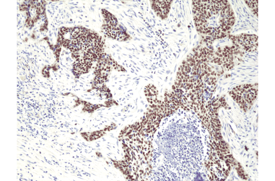 Immunohistochemistry - Anti-p40 - DeltaNp63 Antibody [RM392] (A121422) - Antibodies.com