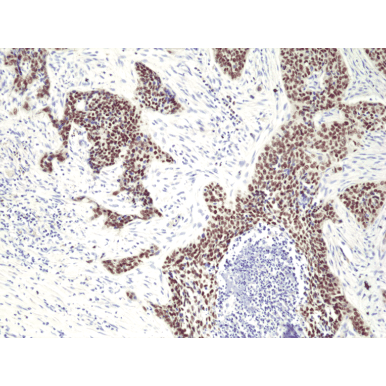 Immunohistochemistry - Anti-p40 - DeltaNp63 Antibody [RM392] (A121422) - Antibodies.com