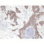 Immunohistochemistry - Anti-p40 - DeltaNp63 Antibody [RM392] (A121422) - Antibodies.com