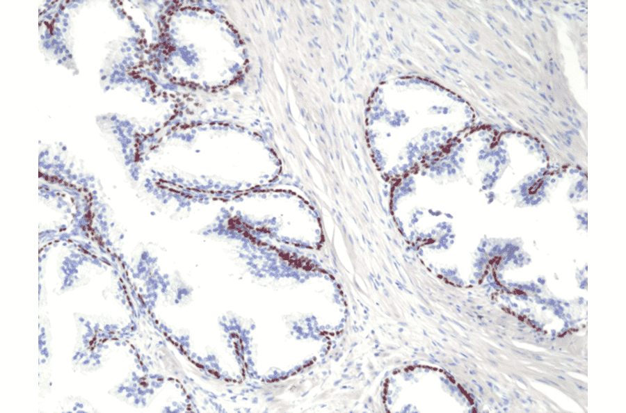 Immunohistochemistry - Anti-p40 - DeltaNp63 Antibody [RM392] (A121444) - Antibodies.com