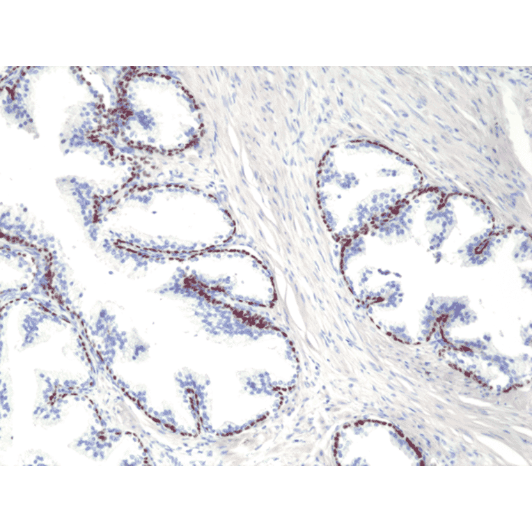 Immunohistochemistry - Anti-p40 - DeltaNp63 Antibody [RM392] (A121444) - Antibodies.com