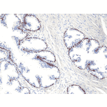 Immunohistochemistry - Anti-p40 - DeltaNp63 Antibody [RM392] (A121444) - Antibodies.com