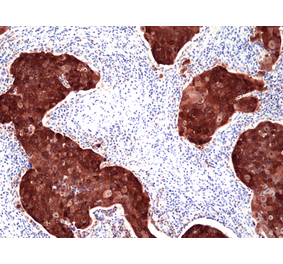 Immunohistochemistry - Anti-p16INK4a Antibody [RM409] (A121421) - Antibodies.com