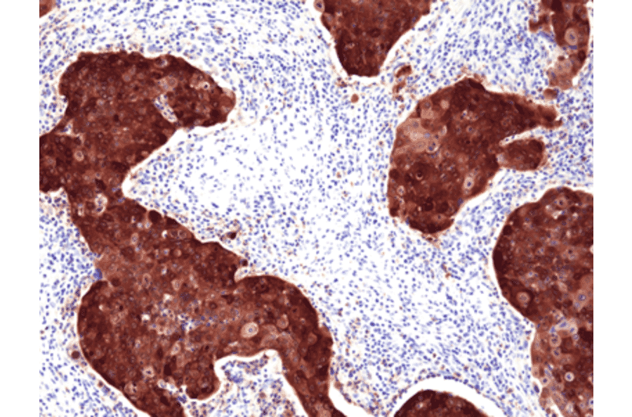 Immunohistochemistry - Anti-p16INK4a Antibody [RM409] (A121421) - Antibodies.com