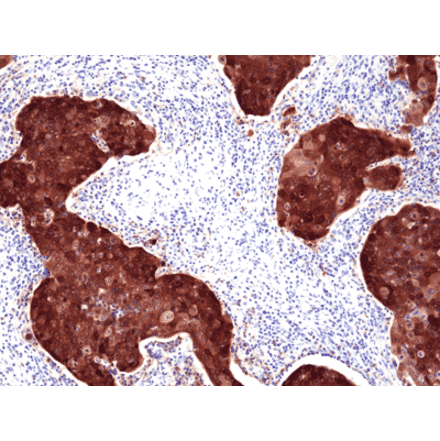 Immunohistochemistry - Anti-p16INK4a Antibody [RM409] (A121421) - Antibodies.com