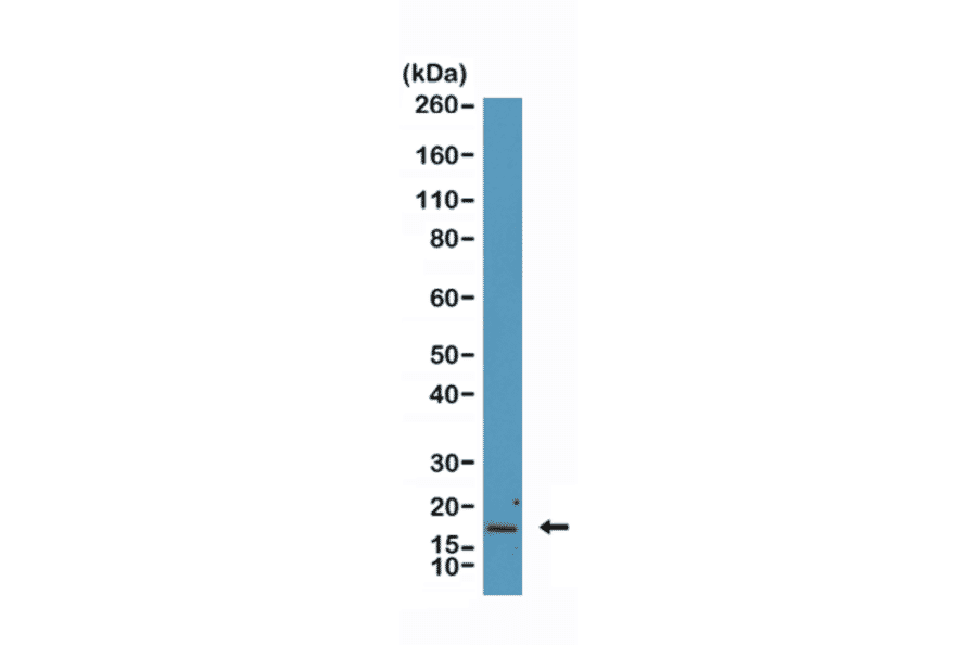 Western Blot - Anti-p16INK4a Antibody [RM409] (A121445) - Antibodies.com