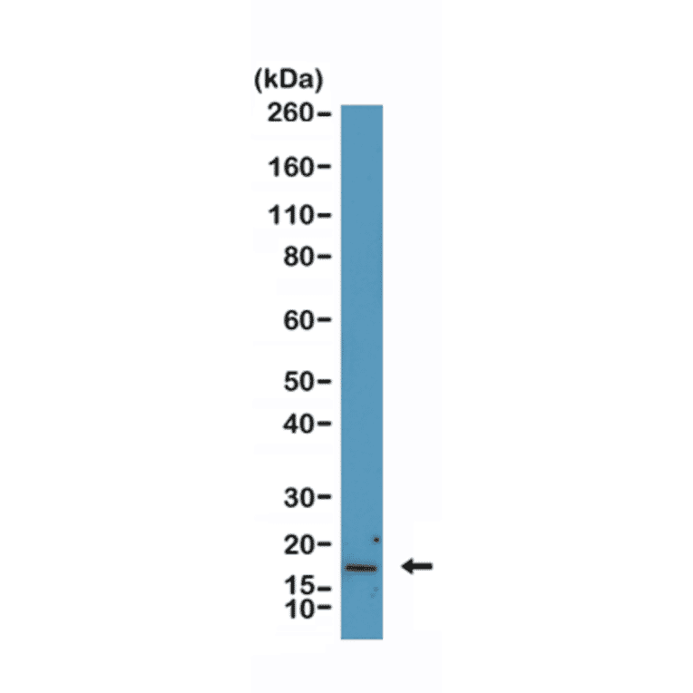Western Blot - Anti-p16INK4a Antibody [RM409] (A121445) - Antibodies.com