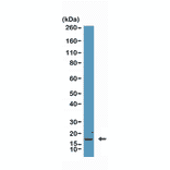 Western Blot - Anti-p16INK4a Antibody [RM409] (A121445) - Antibodies.com