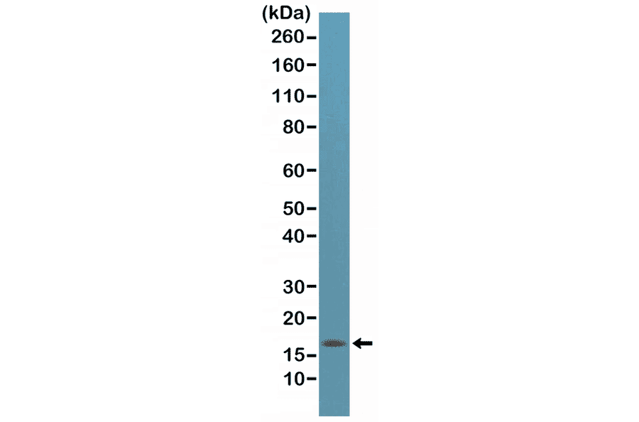 Western Blot - Anti-p14ARF Antibody [RM267] (A121446) - Antibodies.com