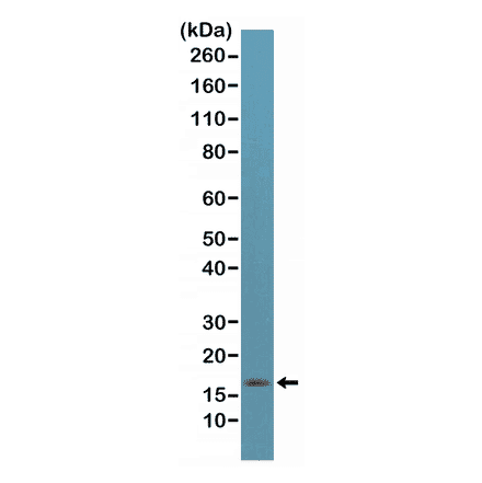 Western Blot - Anti-p14ARF Antibody [RM267] (A121446) - Antibodies.com