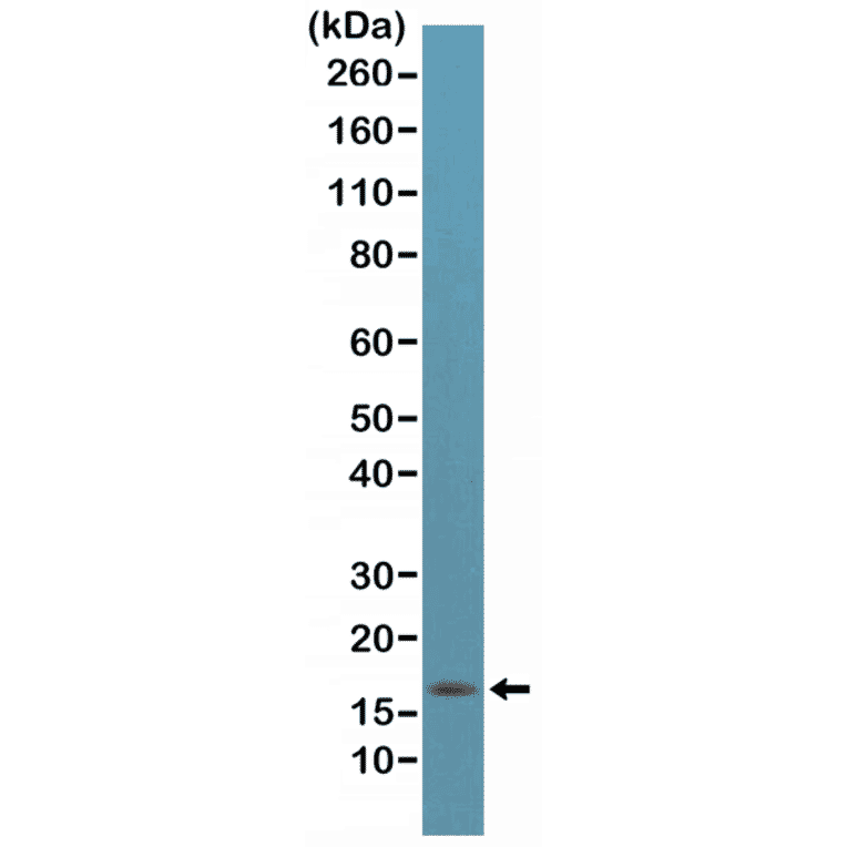 Western Blot - Anti-p14ARF Antibody [RM267] (A121446) - Antibodies.com