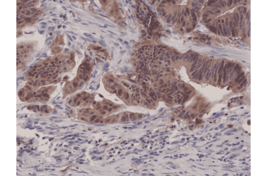 Immunohistochemistry - Anti-p14ARF Antibody [RM267] (A121447) - Antibodies.com