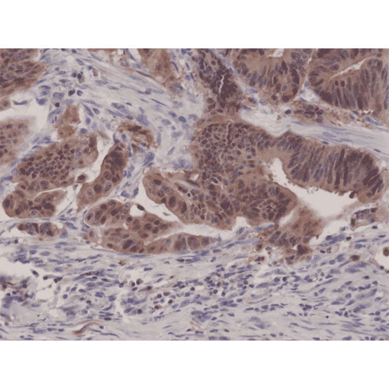 Immunohistochemistry - Anti-p14ARF Antibody [RM267] (A121447) - Antibodies.com