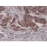 Immunohistochemistry - Anti-p14ARF Antibody [RM267] (A121447) - Antibodies.com