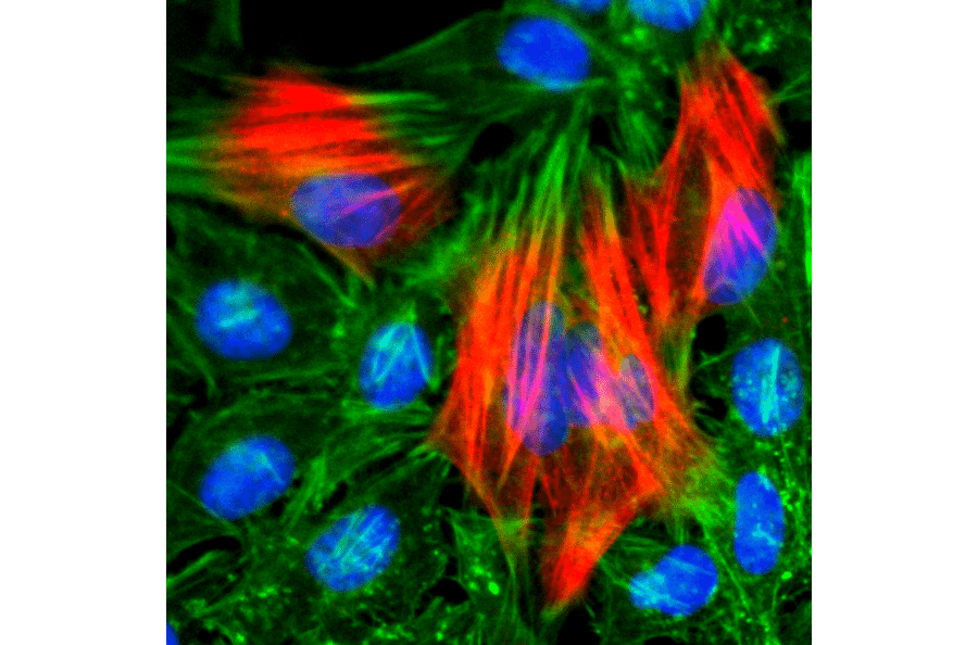 Immunocytochemistry - Anti-Calponin Antibody [RM262] (A121192) - Antibodies.com
